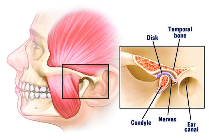 Graphic of the jaw joint: Chiropractic Care for TMJ Disease